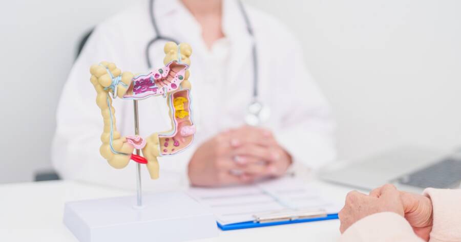 Early Warning Signs of Colon Cancer to Know